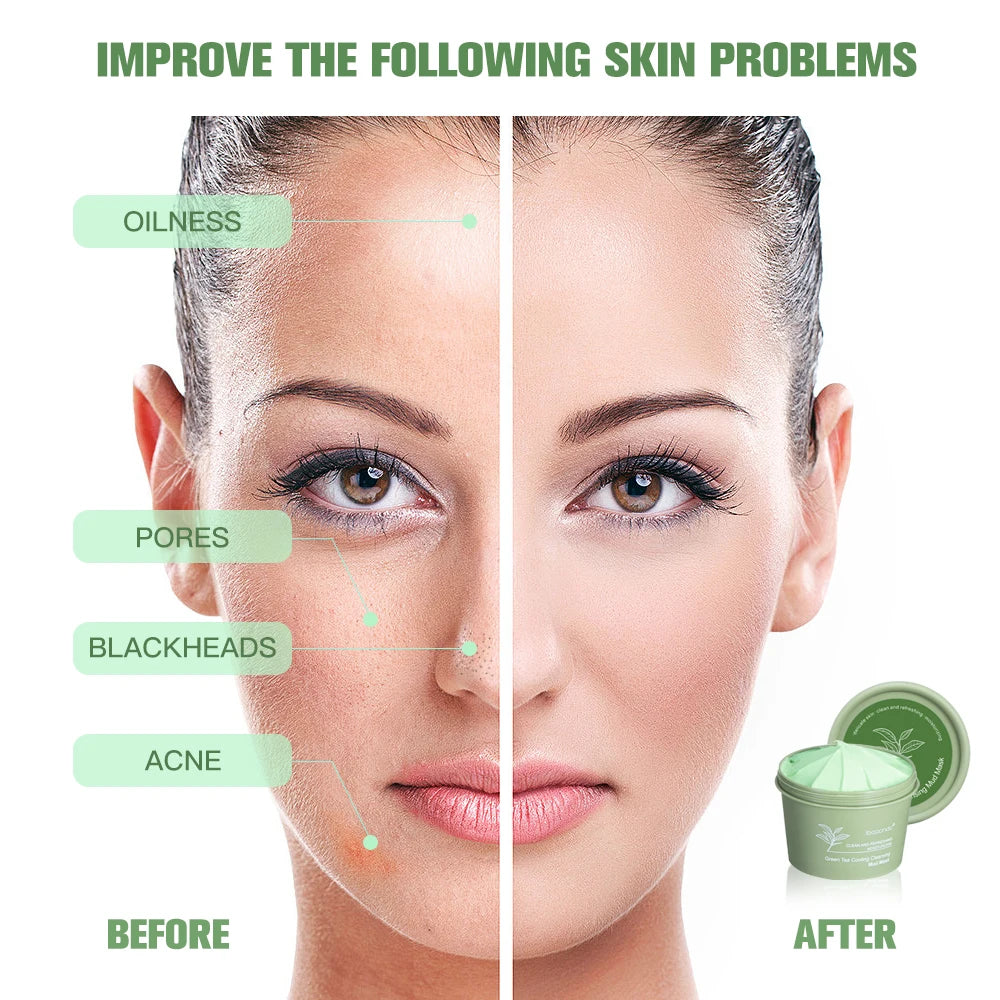 Green Tea Mud Mask – Deep Pore Cleansing, Oil Control & Hydrating Face Care (100g)