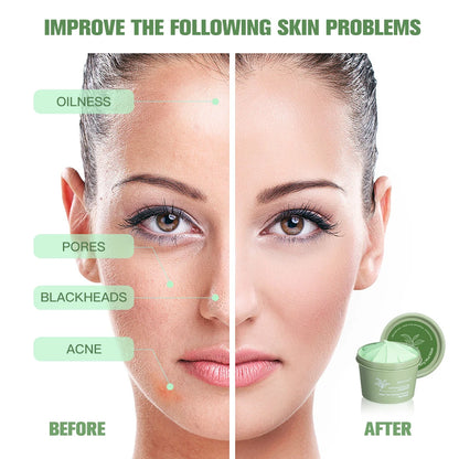 Green Tea Mud Mask – Deep Pore Cleansing, Oil Control & Hydrating Face Care (100g)